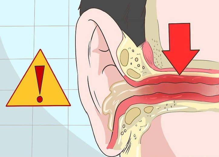 How to Get Water Out of Your Ears