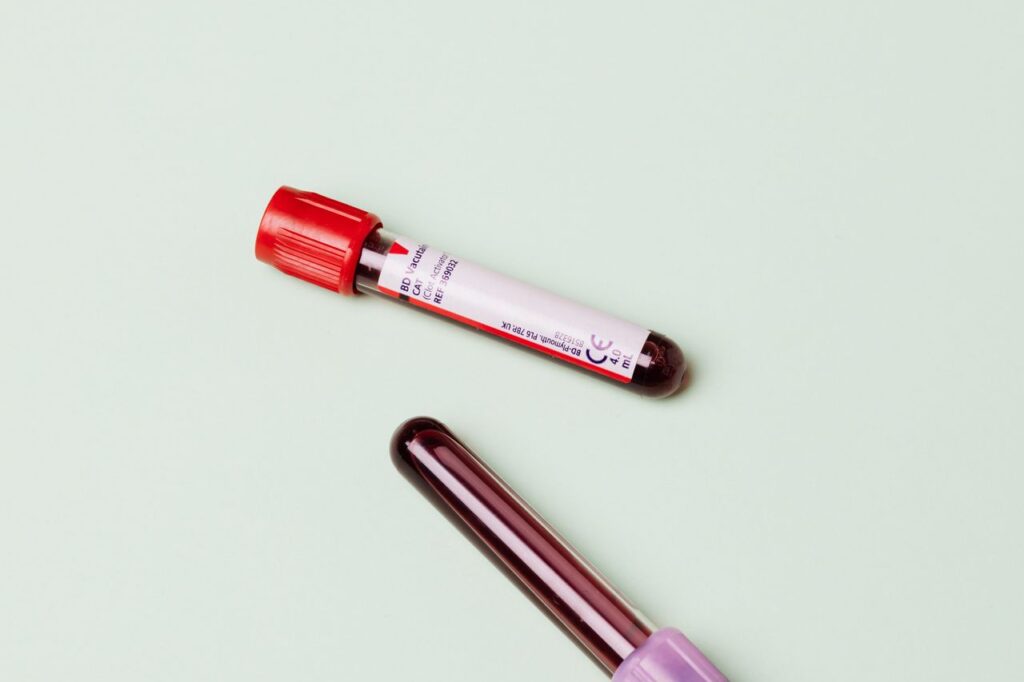 Two blood sample tubes lying on a pale green background